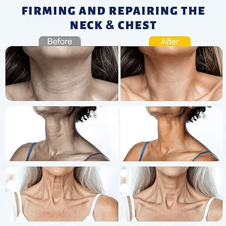 ✨ Seevenlly™ Instant Neck Lift Cream — 🧴 Infused with Retinol & Hyaluronic Acid | Firms the Neck, Reduces Wrinkles & Double Chin