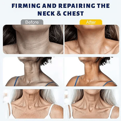 ✨ Seevenlly™ Instant Neck Lift Cream — 🧴 Infused with Retinol & Hyaluronic Acid | Firms the Neck, Reduces Wrinkles & Double Chin